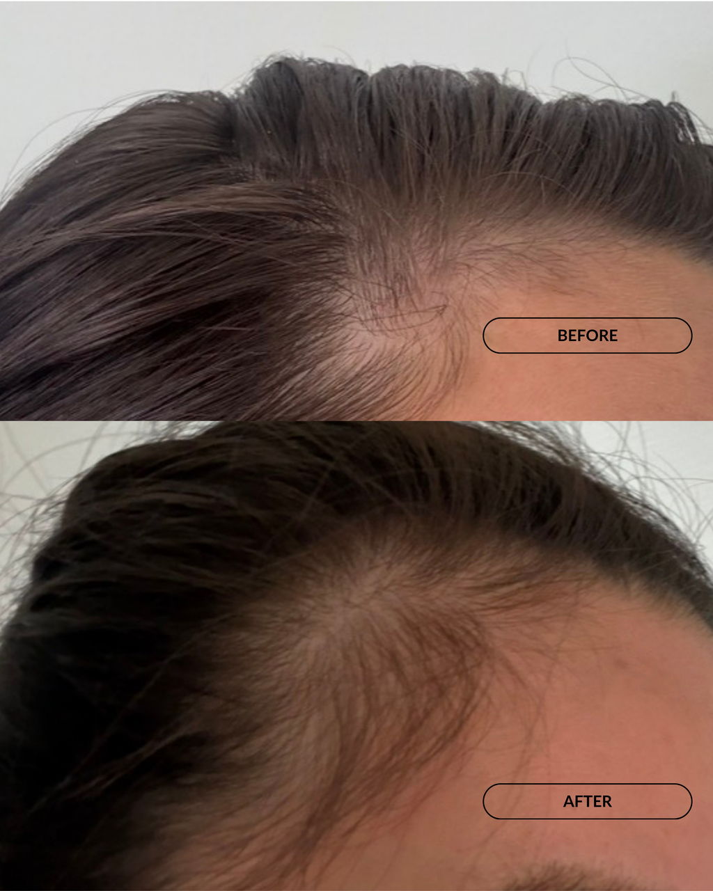 sāch infused with fig oil scalp serum before and after